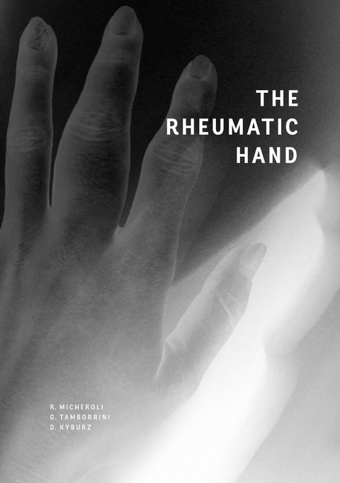 The Rheumatic Hand - Raphael Micheroli, Giorgio Tamborrini, Diego Kyburz