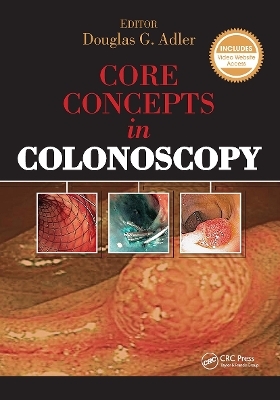 Core Concepts in Colonoscopy - Douglas Adler