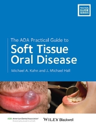 The ADA Practical Guide to Soft Tissue Oral Disease - Michael A. Kahn, J. Michael Hall