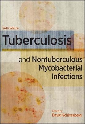 Tuberculosis and Nontuberculous Mycobacterial Infections, - David Schlossberg