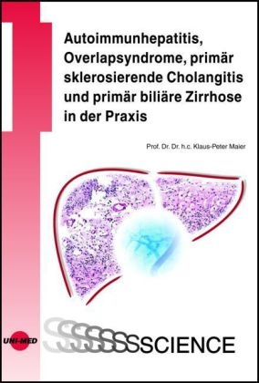 Autoimmunhepatitis, Overlapsyndrome, primÃ¤r sklerosierende Cholangitis und primÃ¤r biliÃ¤re Zirrhose in der Praxis - Klaus-Peter Maier