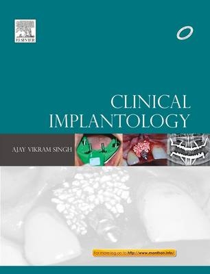 Clinical Implantology - Ajay Vikram Singh