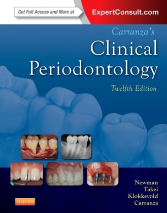 Carranza's Clinical Periodontology - Michael G. Newman, Henry Takei, Perry R. Klokkevold, Fermin A. Carranza