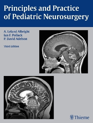 Principles and Practice of Pediatric Neurosurgery - A. Leland Albright, Ian F. Pollack, P. David Adelson