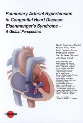 Pulmonary Arterial Hypertension in Congenital Heart Disease: Eisenmengers Syndrome - A Global Perspective - 