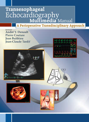 Transesophageal Echocardiography Multimedia Manual, first edition - 