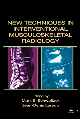 New Techniques in Interventional Musculoskeletal Radiology - 