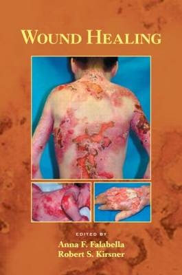 Wound Healing - 