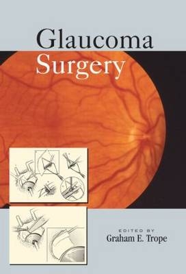 Glaucoma Surgery - 