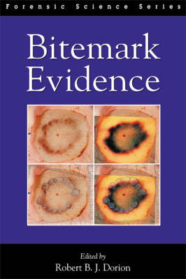 Bitemark Evidence - 