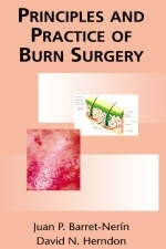 Principles and Practice of Burn Surgery - 