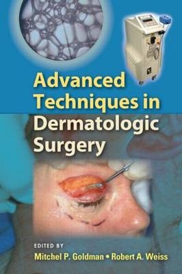 Advanced Techniques in Dermatologic Surgery - 