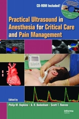 Practical Ultrasound in Anesthesia for Critical Care and Pain Management - 