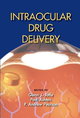 Intraocular Drug Delivery - 