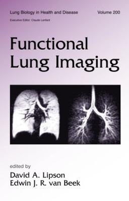 Functional Lung Imaging - 