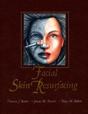 Facial Skin Resurfacing - Thomas J. Baker, James Stuzin, Tracy Baker