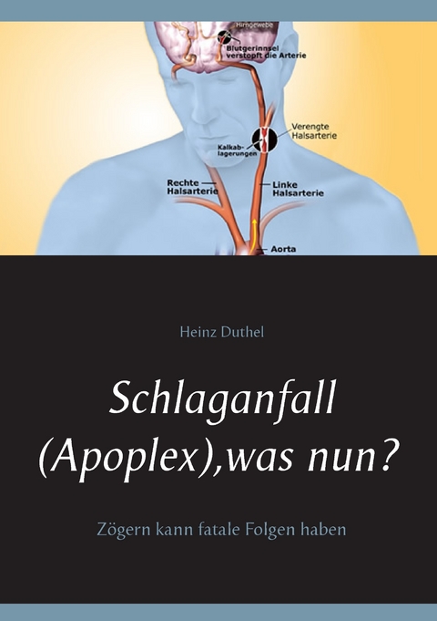 Schlaganfall (Apoplex), was nun? -  Heinz Duthel