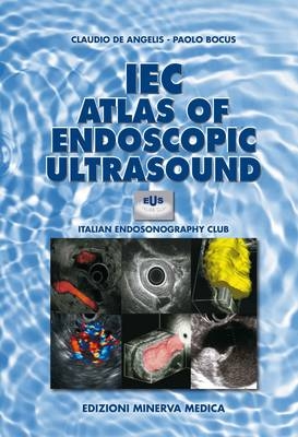 Atlas of Endoscopic Ultrasound - 