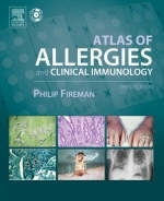 Atlas of Allergies and Clinical Immunology - Philip Fireman