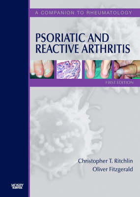 Psoriatic and Reactive Arthritis - Christopher Ritchlin, Oliver Fitzgerald