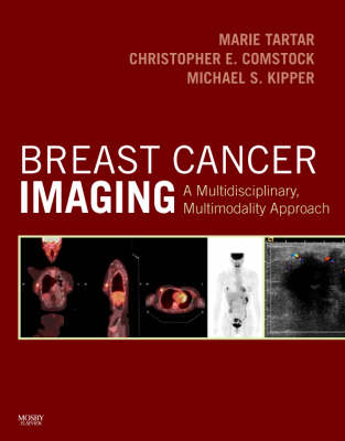 Breast Cancer Imaging - Marie Tartar, Christopher E. Comstock, Michael S. Kipper