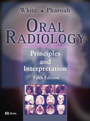 Oral Radiology - Stuart C. White, Michael J. Pharoah