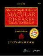 Stereoscopic Atlas of Macular Diseases - J.D.M. Gass