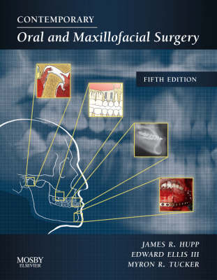 Contemporary Oral and Maxillofacial Surgery - James R. Hupp, Edward Ellis, Myron R. Tucker