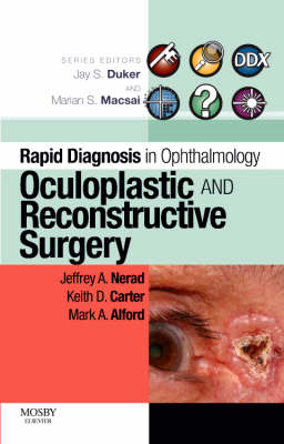 Rapid Diagnosis in Ophthalmology Series: Oculoplastic and Reconstructive Surgery - Jeffrey A. Nerad, Keith D. Carter, Mark Alford