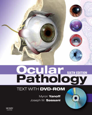 Ocular Pathology - Myron Yanoff, Joseph William Sassani