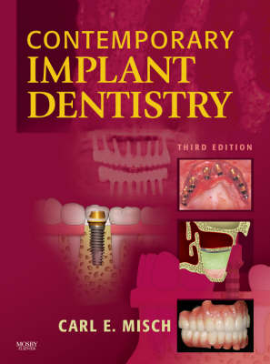Contemporary Implant Dentistry - Carl E. Misch