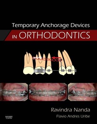 Temporary Anchorage Devices in Orthodontics - Ravindra Nanda