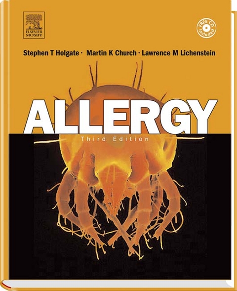 Allergy - Professor Stephen T. Holgate, Martin K. Church, Fernando D. Martinez, Lawrence M. Lichtenstein