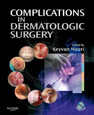 Complications in Dermatologic Surgery - Keyvan Nouri