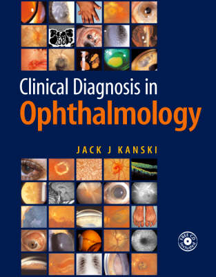 Clinical Diagnosis in Ophthalmology - Jack J. Kanski