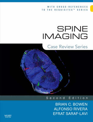 Spine Imaging - Brian C. Bowen, Alfonso Rivera, Efrat Saraf-Lavi