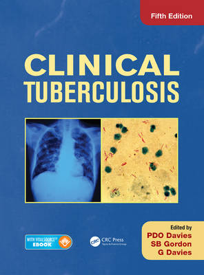 Clinical Tuberculosis - 