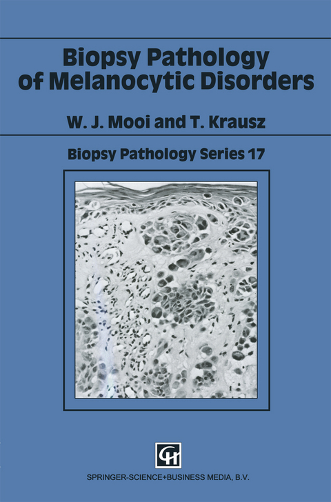 Biopsy Pathology of Melanocytic Disorders - W. J. Mooi, T. Krausz