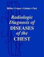 Radiologic Diagnosis of Diseases of the Chest - Nestor L. Muller, Richard S. Fraser, Neil C. Colman, P.D. Pare
