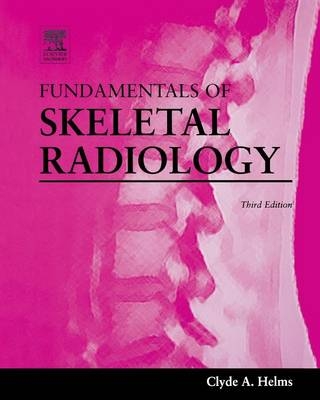 Fundamentals of Skeletal Radiology - Clyde Helms