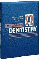 Implants in Dentistry - Michael S. Block, John Norman Kent