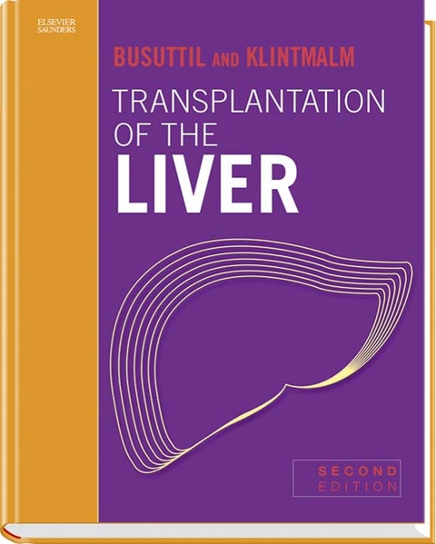 Transplantation of the Liver - Ronald W. Busuttil, Goran B. Klintmalm