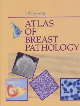 Atlas of Breast Pathology - Steven G. Silverberg