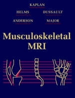 Musculoskeletal MRI - Phoebe Kaplan, Clyde Helms, Robert Dussault, Mark W. Anderson, Nancy M. Major