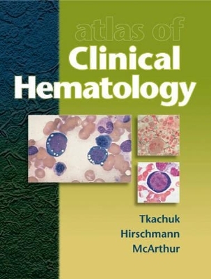 Atlas of Clinical Hematology - Douglas Tkachuk, J.V. Hirschmann, James R. McArthur