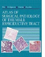 Atlas of Surgical Pathology of the Male Reproductive Tract - Jae Y. Ro, David J. Grignon, Mahul B. Amin, Alberto G. Ayala