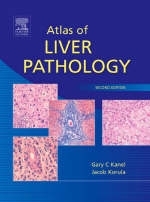 Atlas of Liver Pathology - Gary C. Kanel, Jacob Korula