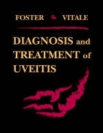 Diagnosis and Treatment of Uveitis - C. Stephen Foster, Albert T. Vitale