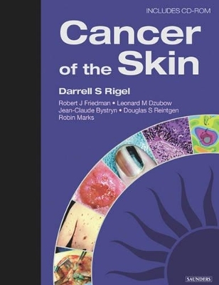 Cancer of the Skin - Darrell S. Rigel, Robert Friedman, Leonard M. Dzubow, Douglas S. Reintgen, Jean-Claude Bystryn