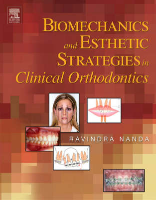 Biomechanics and Esthetic Strategies in Clinical Orthodontics - Ravindra Nanda